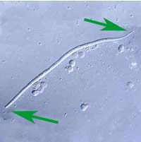 Case 24 Image D