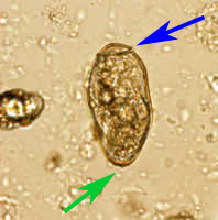 Case 27 Image A