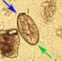 Case 27 Image B