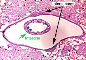Case 46 Image A