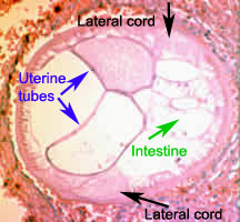 Case 46 Image B