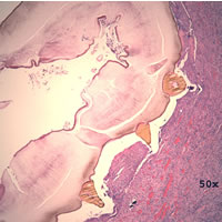 Case 98 Image A