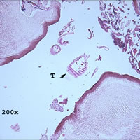 Case 98 Image B
