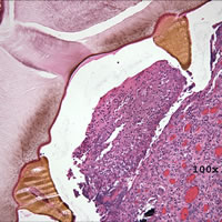 Case 98 Image C
