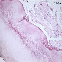 Case 98 Image D