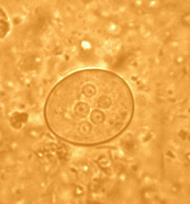 E. coli cyst