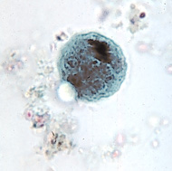 E. coli cyst