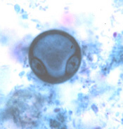 E. coli binucleate cyst