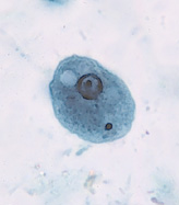 E. coli trophozoite
