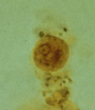 E. hartmanni cyst