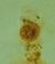 E. hartmanni cyst