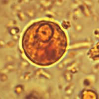 E. histolytica/dispar cyst 