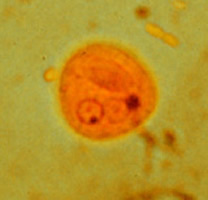 E. histolytica/dispar cyst 