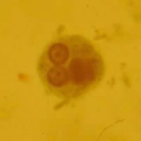 E. histolytica/dispar cyst 