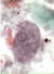 E. histolytica/dispar trophozoite