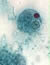E. histolytica trophozoite with ingested erythrocyte