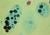 E. histolytica trophozoite with ingested erythrocytes