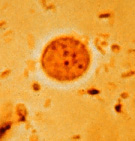E. nana cyst 