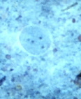 E. nana cyst 
