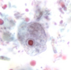 E. nana trophozoite 