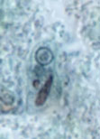 E. polecki cyst