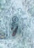 E. polecki cyst