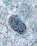 E. polecki cyst