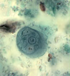 E. polecki trophozoite