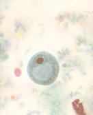 I. buetschlii cyst