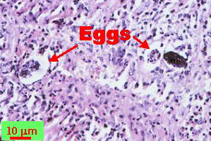 A. costaricensis eggs