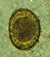 A. lumbricoides fertilized egg