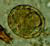 A. lumbricoides fertilized egg