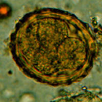 A. lumbricoides fertilized egg