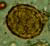 A. lumbricoides fertilized egg