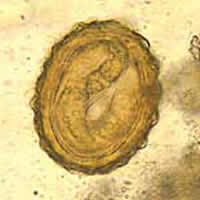 A. lumbricoides egg containing a larva