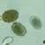 A. lumbricoides eggs, fertile and decorticated