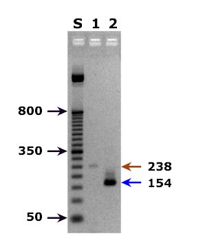 Agarose gel- PCR for Babesia