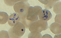 Babesia tetrads