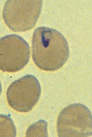 Babesia