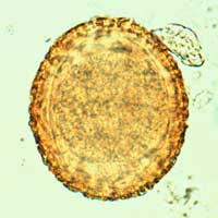 Unembryonated egg of B. procyonis