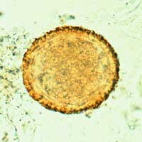 Unembryonated egg of B. procyonis