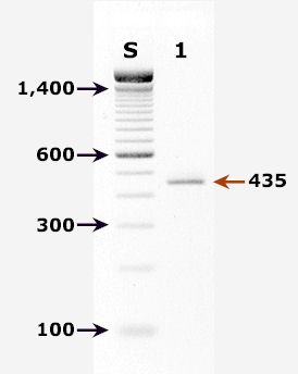 Agarose gel - PCR for Cryptosporidium