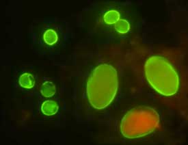 Cysts of Giardia intestinalis and oocysts of C. parvum