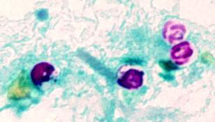 C. parvum oocysts, acid-fast