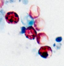 C. parvum oocysts, acid-fast