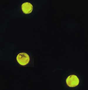 C. parvum oocysts auramine-rhodamine stain