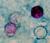 Cyclospora, modified acid-fast stain