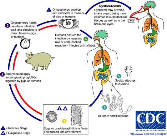 Life cycle of T. solium with resulting cysticercosis