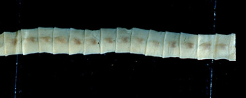 Diphyllobothrium latum proglottids