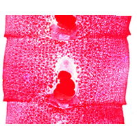 Diphyllobothrium latum proglottids